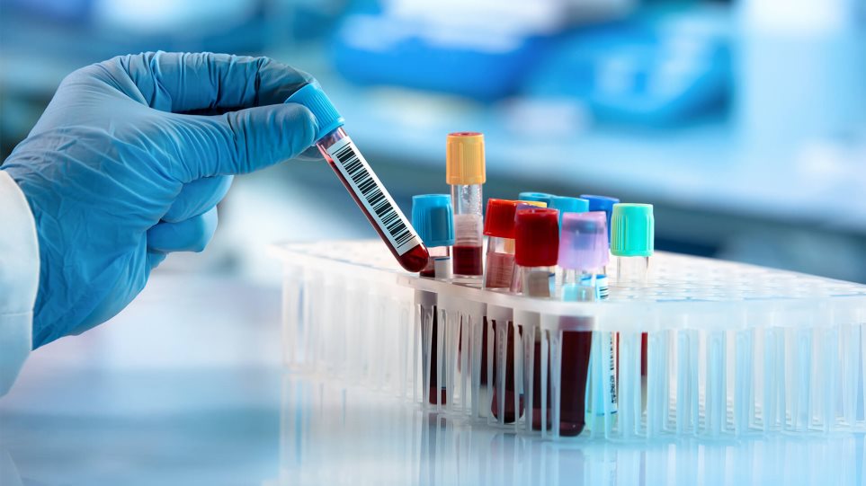 Καλά νέα στην μελέτη για τη διάγνωση του καρκίνου: Νέα μέθοδος ανίχνευσης βιοδείκτη σε αίμα
