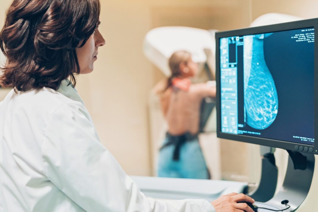 Δωρεάν μαστογραφία: Νέο εθνικό πρόγραμμα για την πρόληψη του καρκίνου του μαστού
