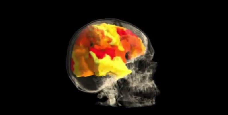 O ανθρώπινος εγκέφαλος έχει μεγαλώσει κατά 7% από το 1930 – Ο δείκτης νοημοσύνης έχει υποχωρήσει