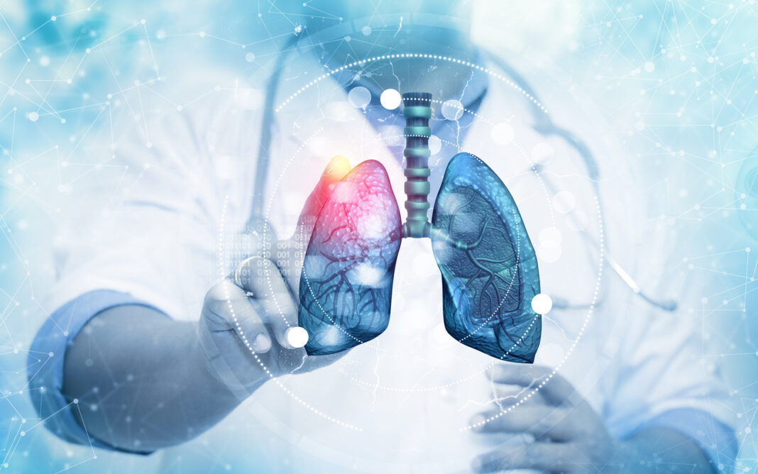 Πρόληψη και αναγνώριση του καρκίνου του πνεύμονα σε πρώιμα στάδια
